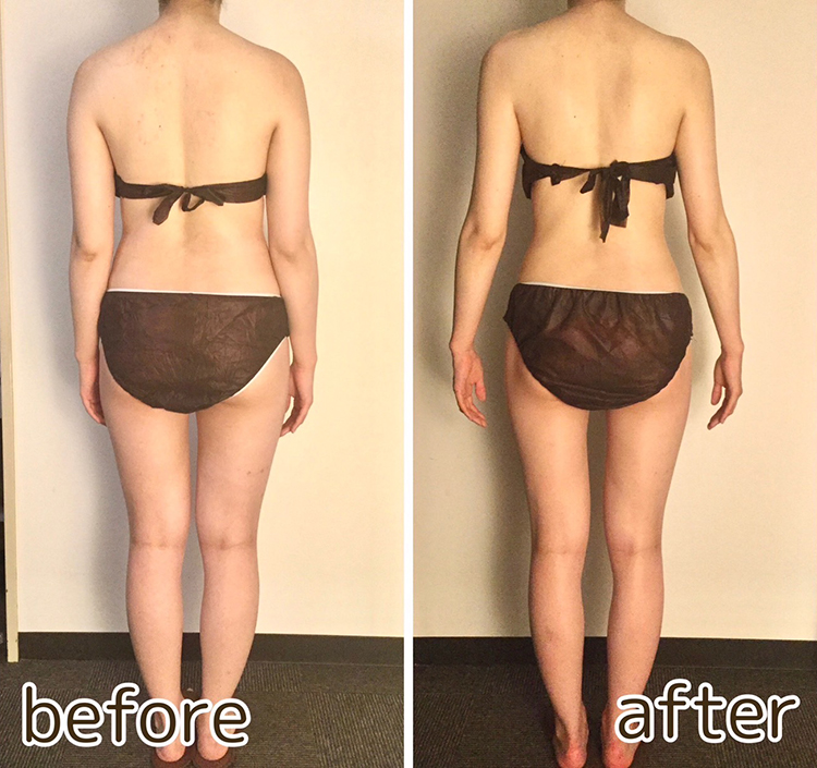 施術ビフォー・アフター